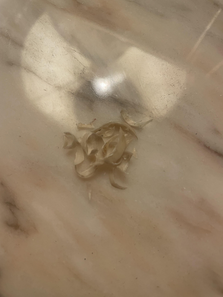 Fingernägel und Fußnägel abgeknipst.
